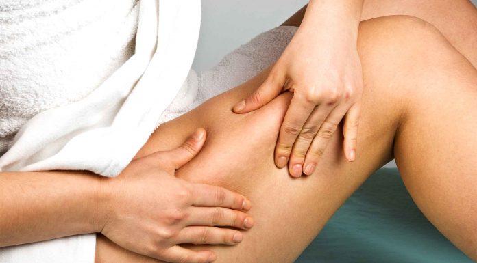 5 Tips on How to Get Rid of Cellulite for Women